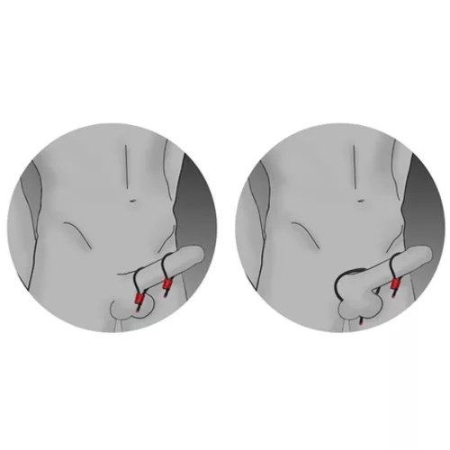 Electrastim Prestige – állítható péniszgyűrűk, piros