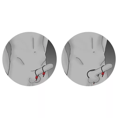 Electrastim Prestige – állítható péniszgyűrűk fekete színben